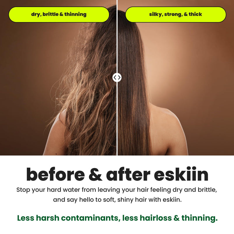Eskiin Filtered Showerhead With Filters For Healthy Hair & Skin